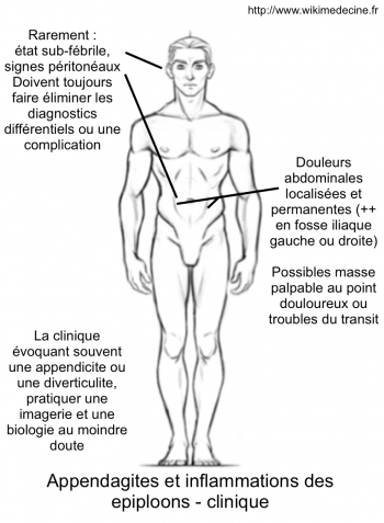 Appendagite et inflammation des epiploons - sémiologie clinique