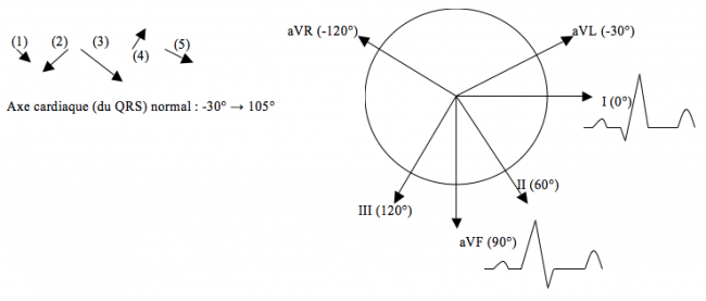 dépolarisation et axe cardiaque