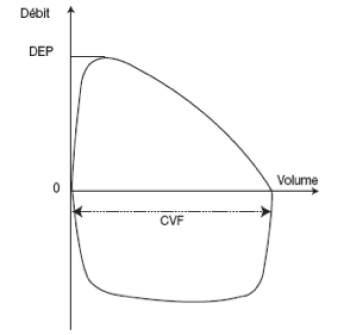 Epreuves fonctionnelles respiratoires (EFR) - Courbe débit-volume