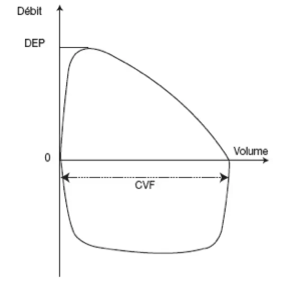 Courbe débit-volume. L'expiration est représentée par la courbe supérieure, l'inspiration par la courbe inférieure. CVF = capacité vitale forcée, DEP = débit expiratoire de pointe.