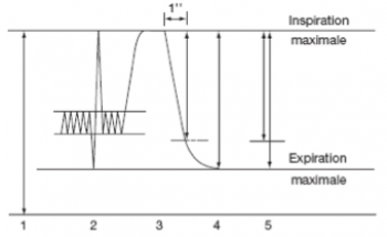 Epreuves fonctionnelles respiratoires (EFR) - Courbe volume-temps