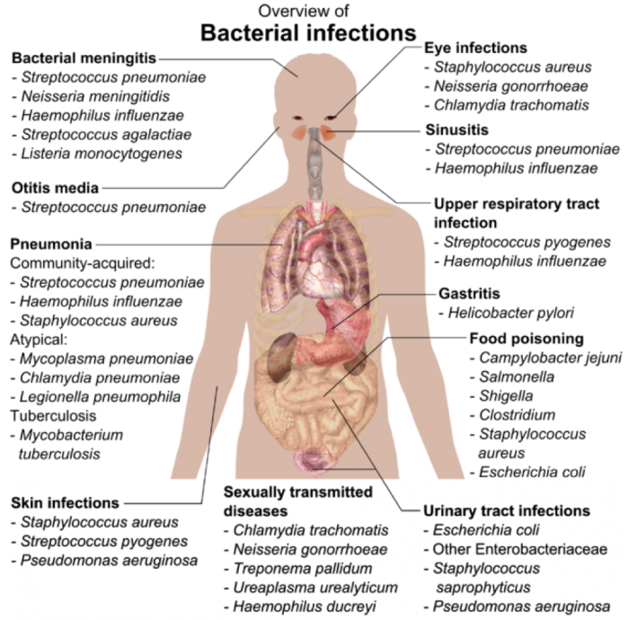 Représentation schématique des sites d'infections bactériennes