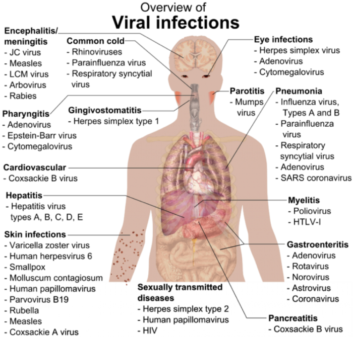 Représentation schématique des sites d'infections virales