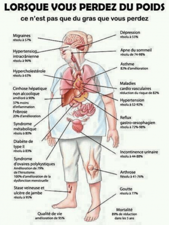 Obésité - complications médicales