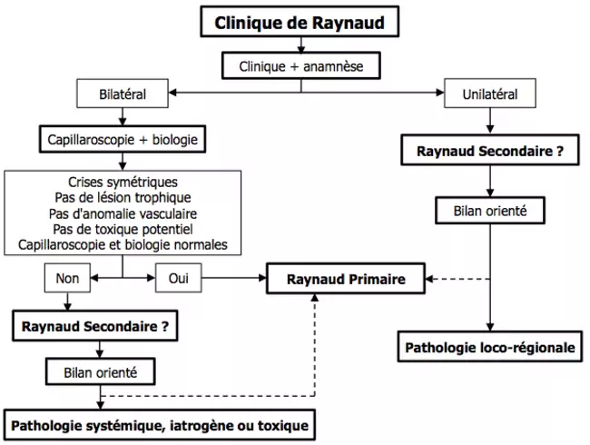Syndrome de Raynaud - Démarche diagnostique