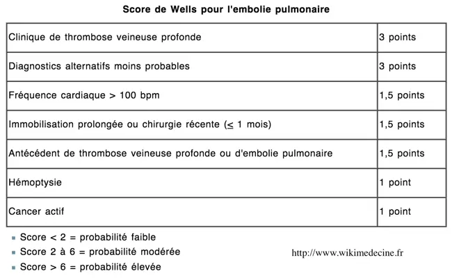 Score de Wells pour les embolies pulmonaires